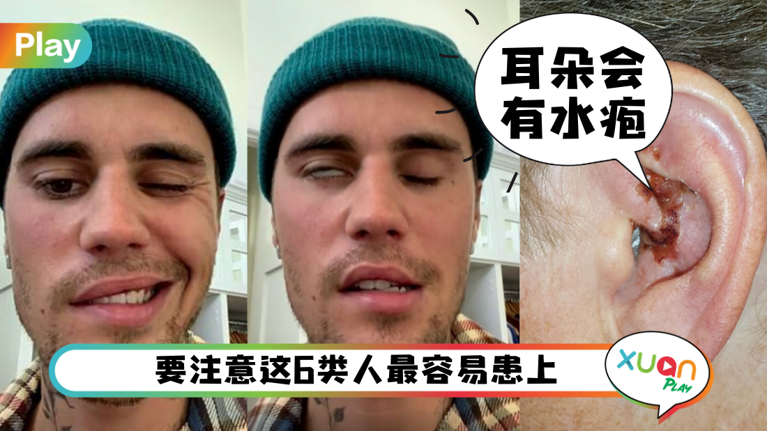 jb-sick.png