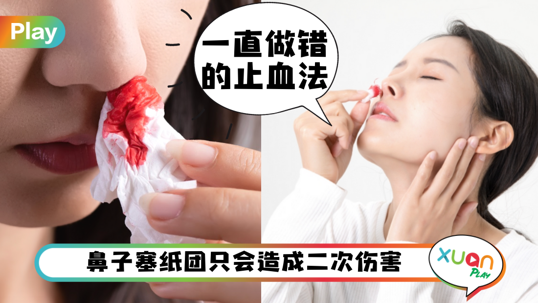 stop-nose-bleeding.png