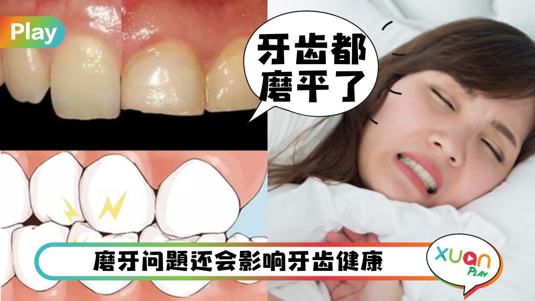 why-molar.png