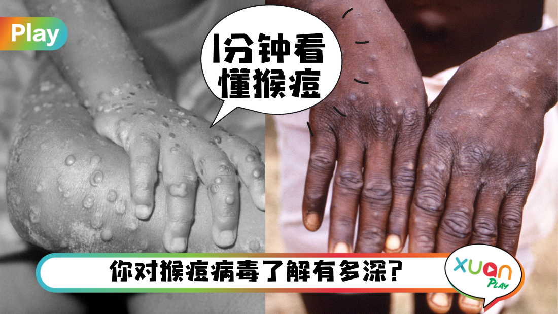 monkeypox.png