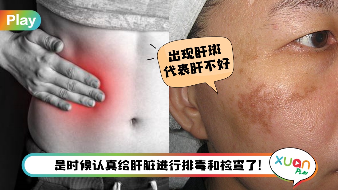 liver-takecare.jpg