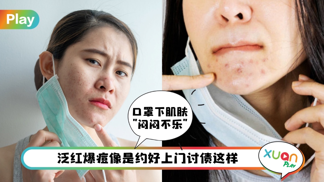 mask-acne-skin.jpg
