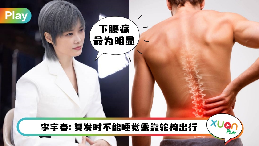 ankylosing-spondylitis.jpg