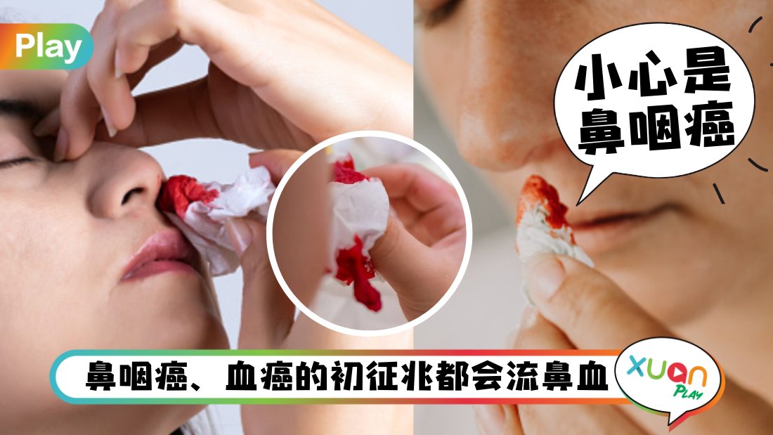 aware-nose-bleeding.jpg
