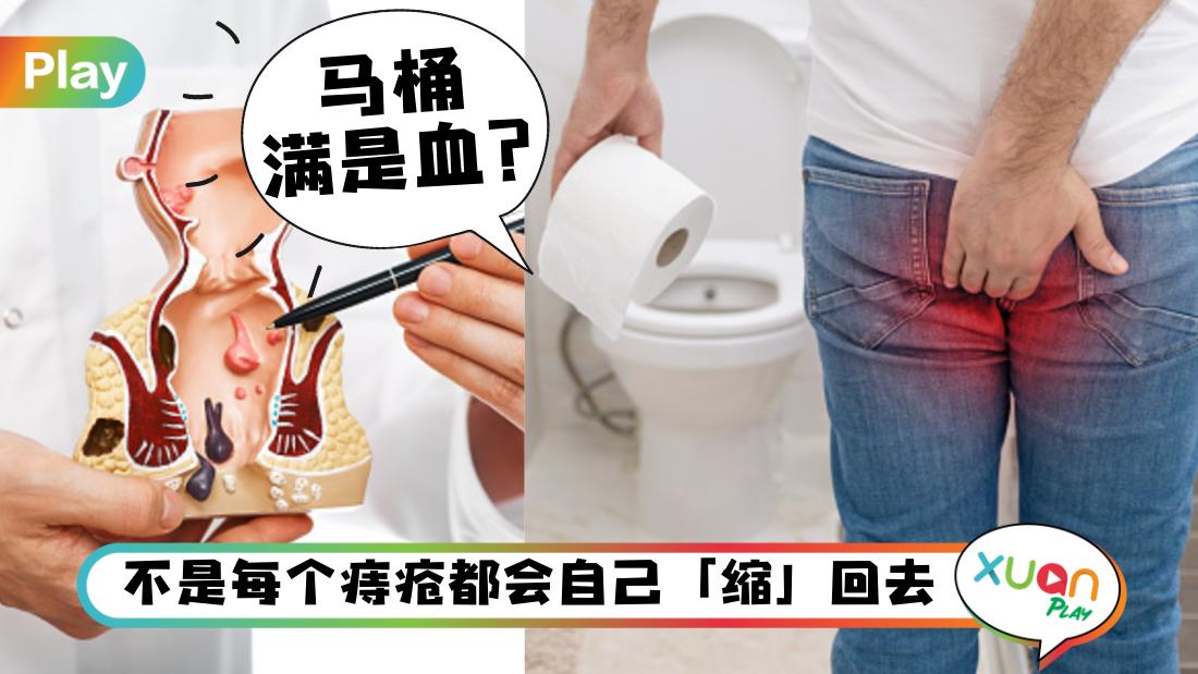 causes-of-hemorrhoids.jpg