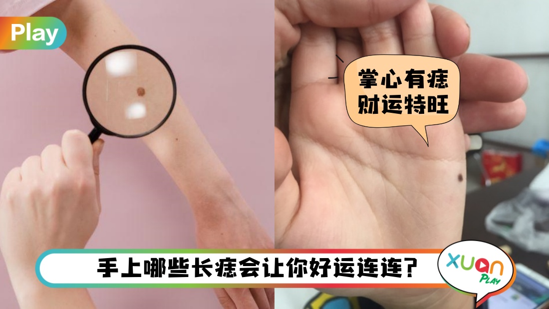 hand-good-mole.jpg