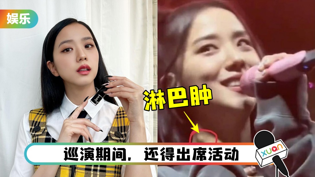 jisoo-neck-main.jpeg