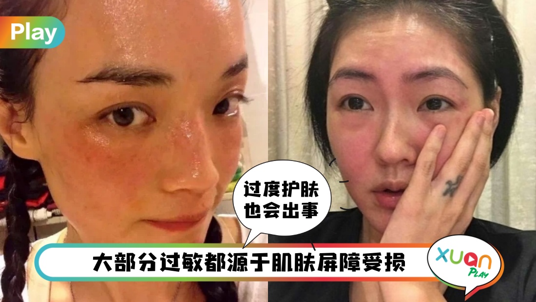 sensitive-skin.jpg