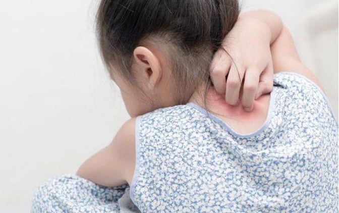 Suu Balm 快速止痒皮肤敏感