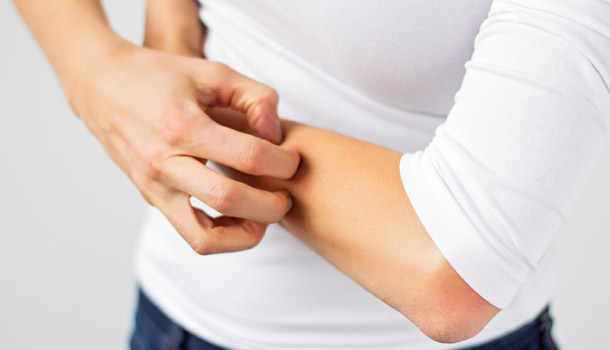 Why Mosquito Bite