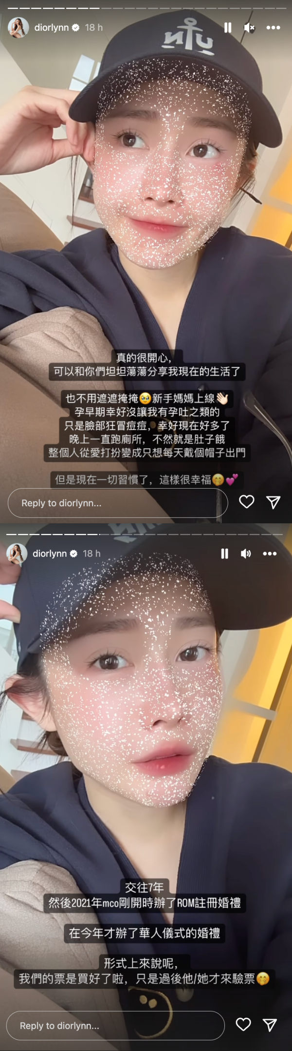 Diorlynn 反击网友质疑
