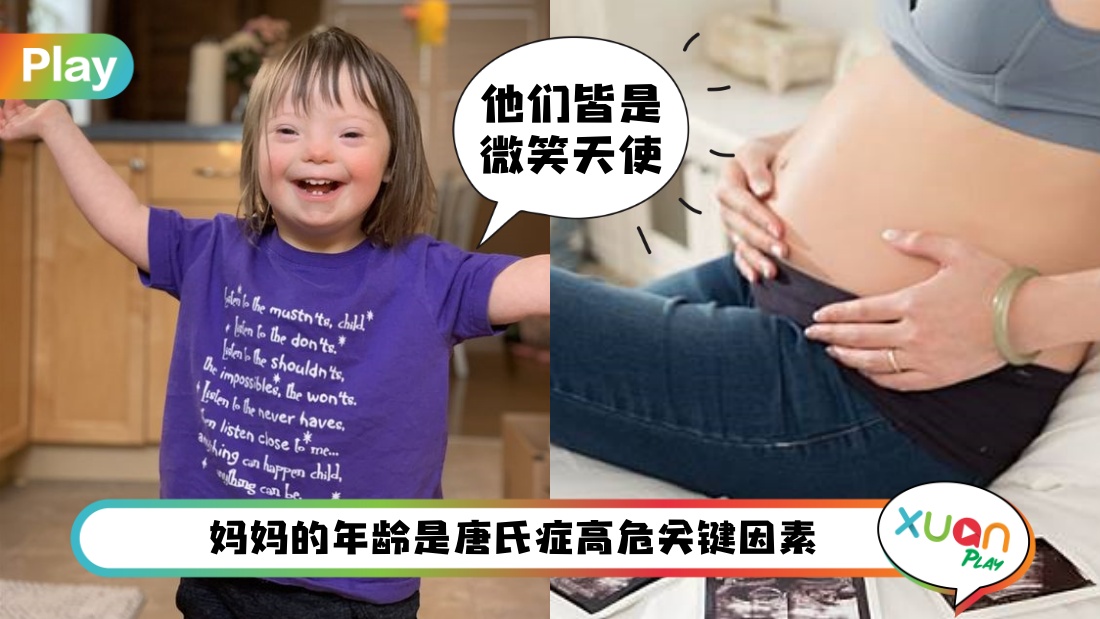 down-syndrome.jpg