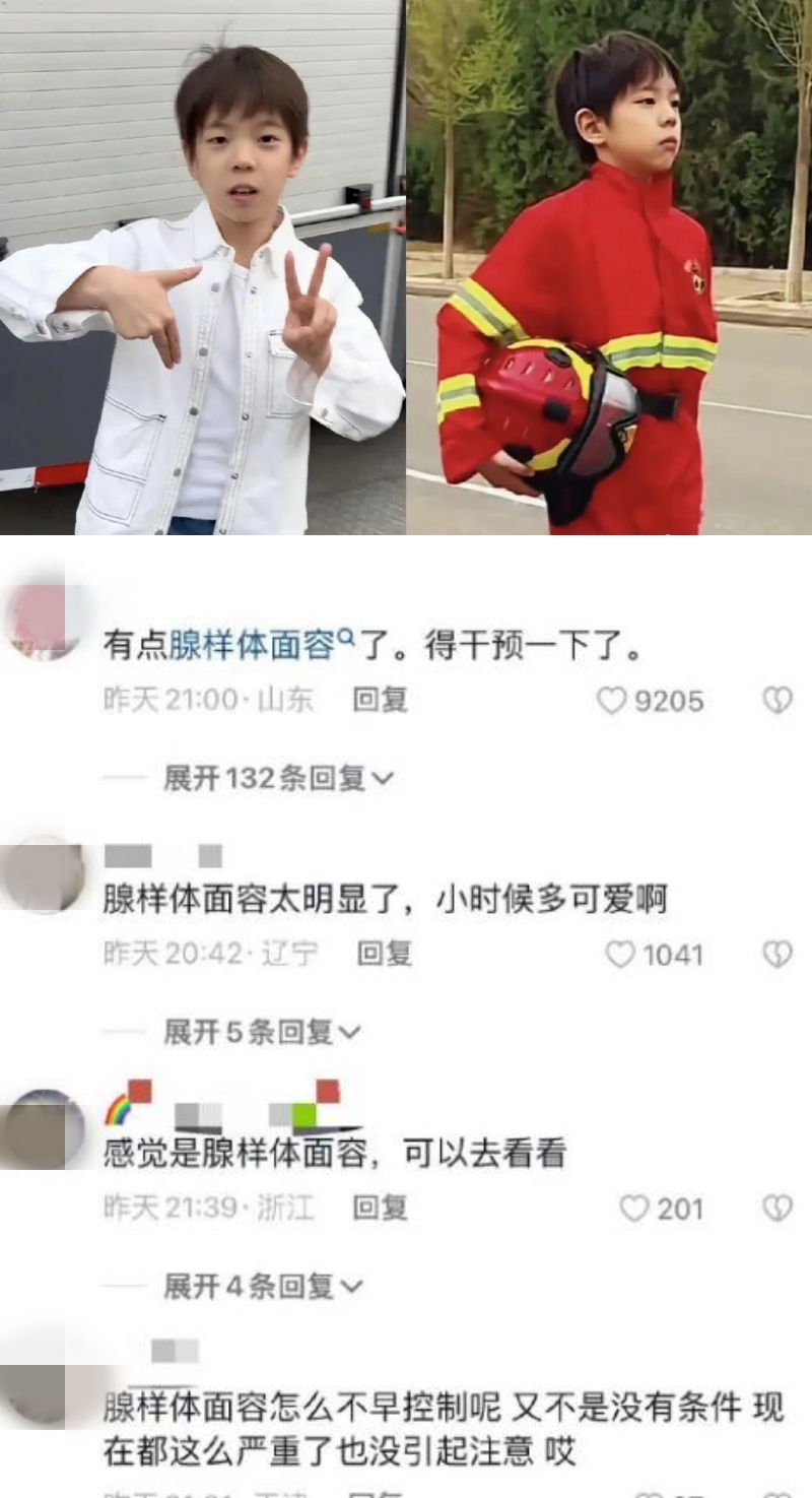 9岁嗯哼被指是腺样体容貌