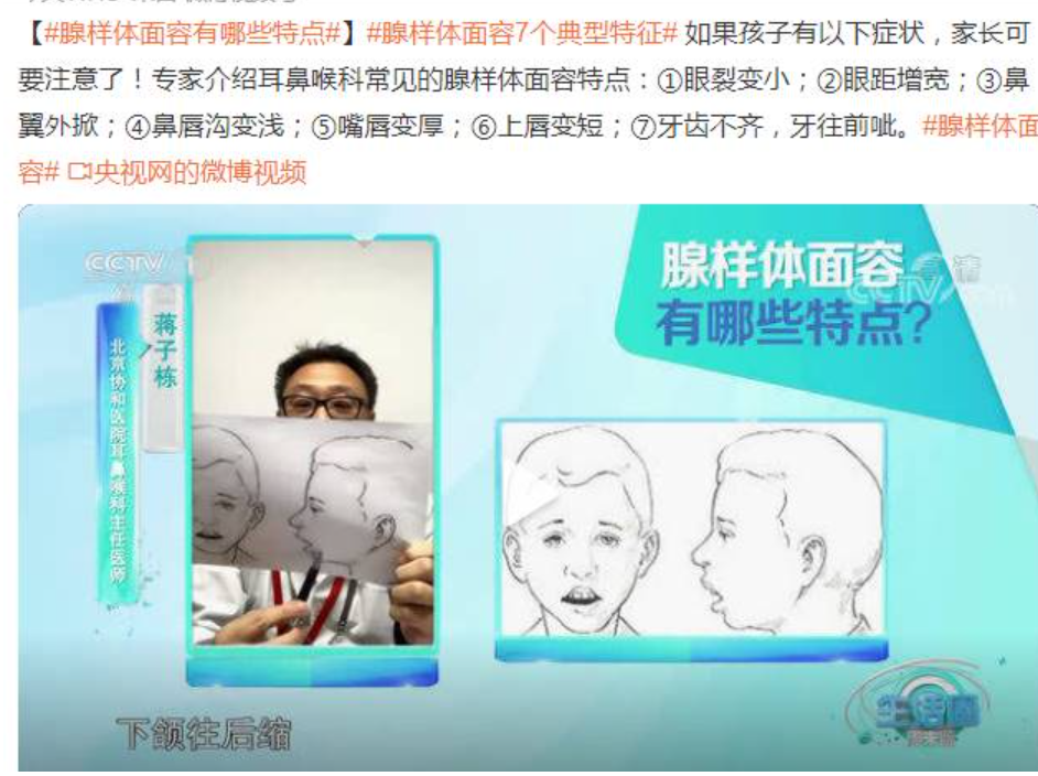 9岁嗯哼被指是腺样体容貌