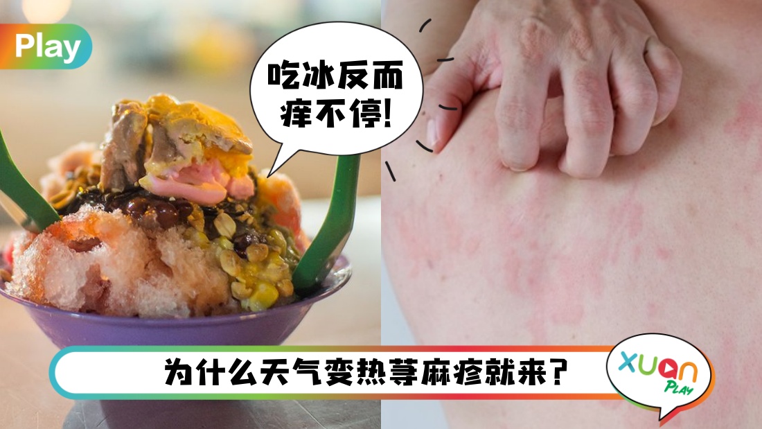 ice-xunmanzheng.jpg