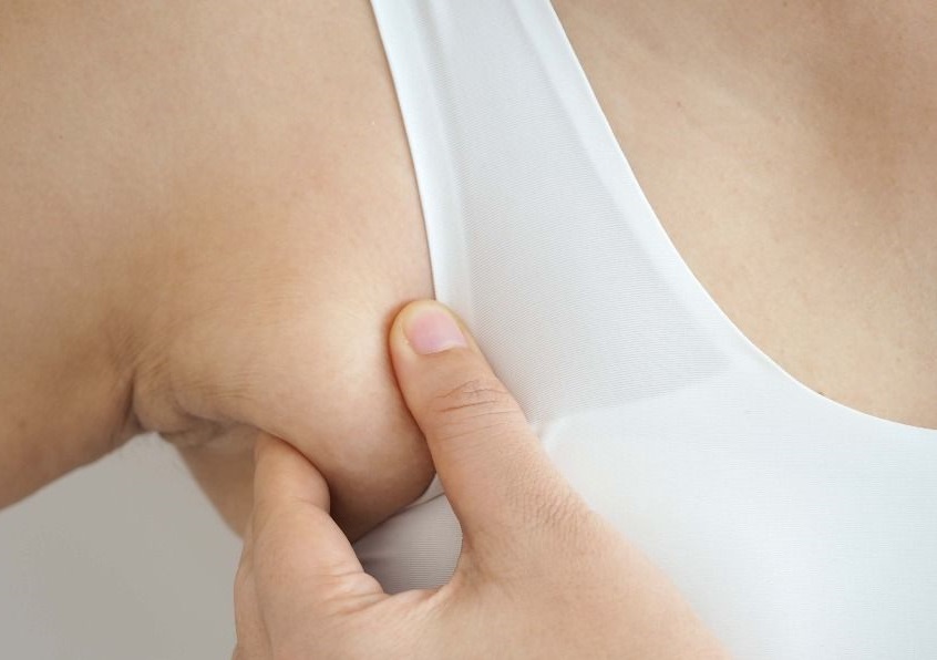 副乳