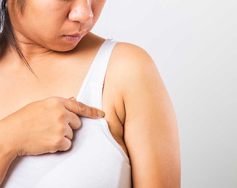 副乳
