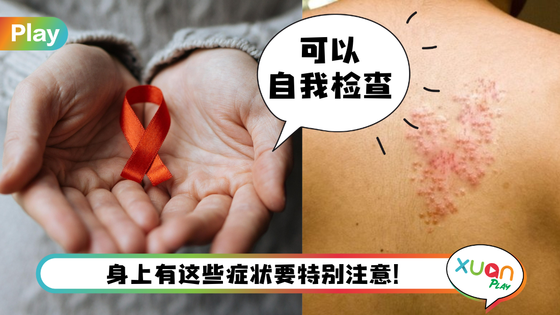 aids-symptoms.png