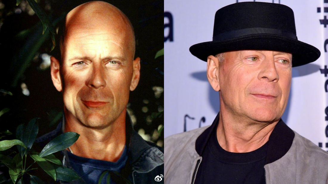 Bruce Willis患上痴呆症