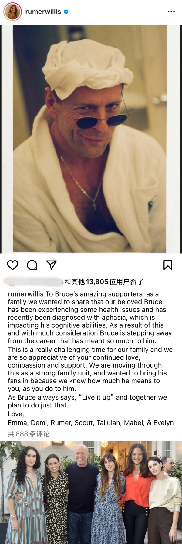 Bruce Willis患上痴呆症