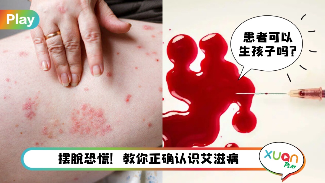 hiv-must-know.jpg