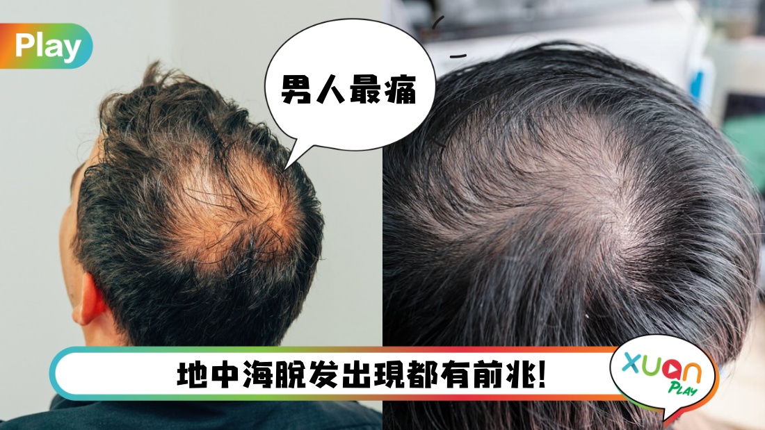 lose-hair-recipe.jpg