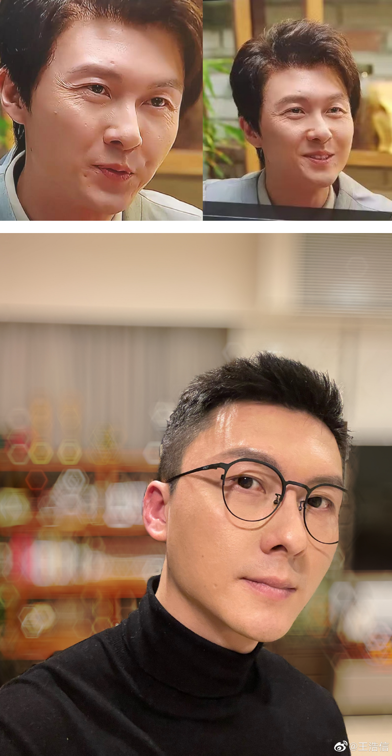 王浩信真面貌颜值大跌