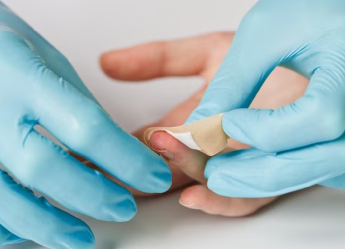 创可贴正确使用法