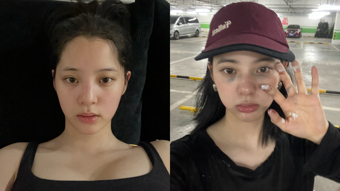 欧阳娜娜罕见晒素颜照