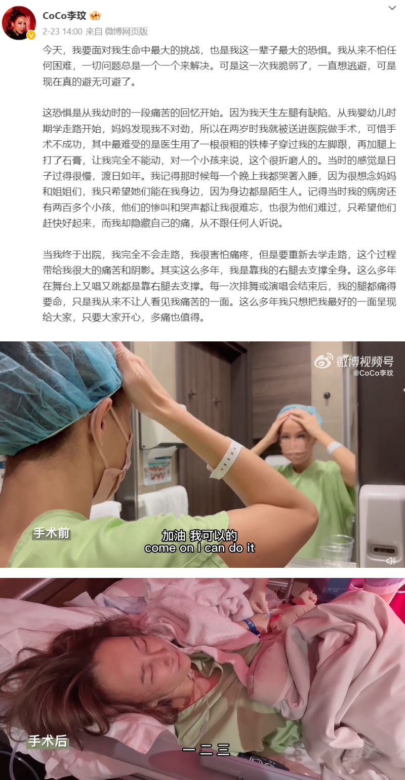 李玟天生左脚有缺陷