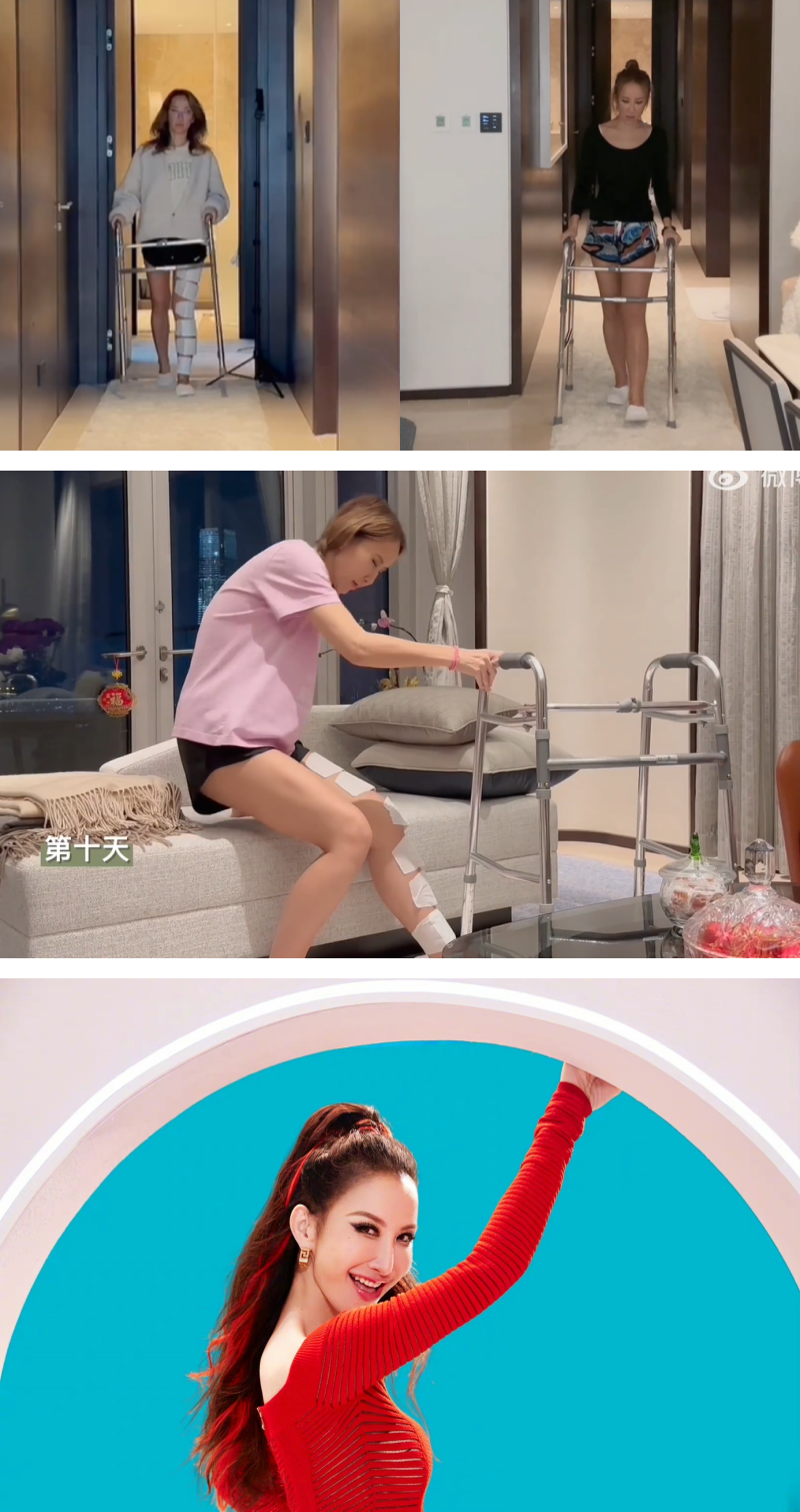 李玟天生左脚有缺陷