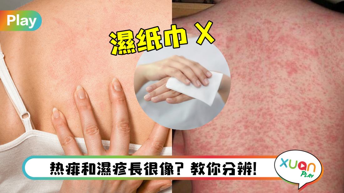 red-rash-eczema.jpg