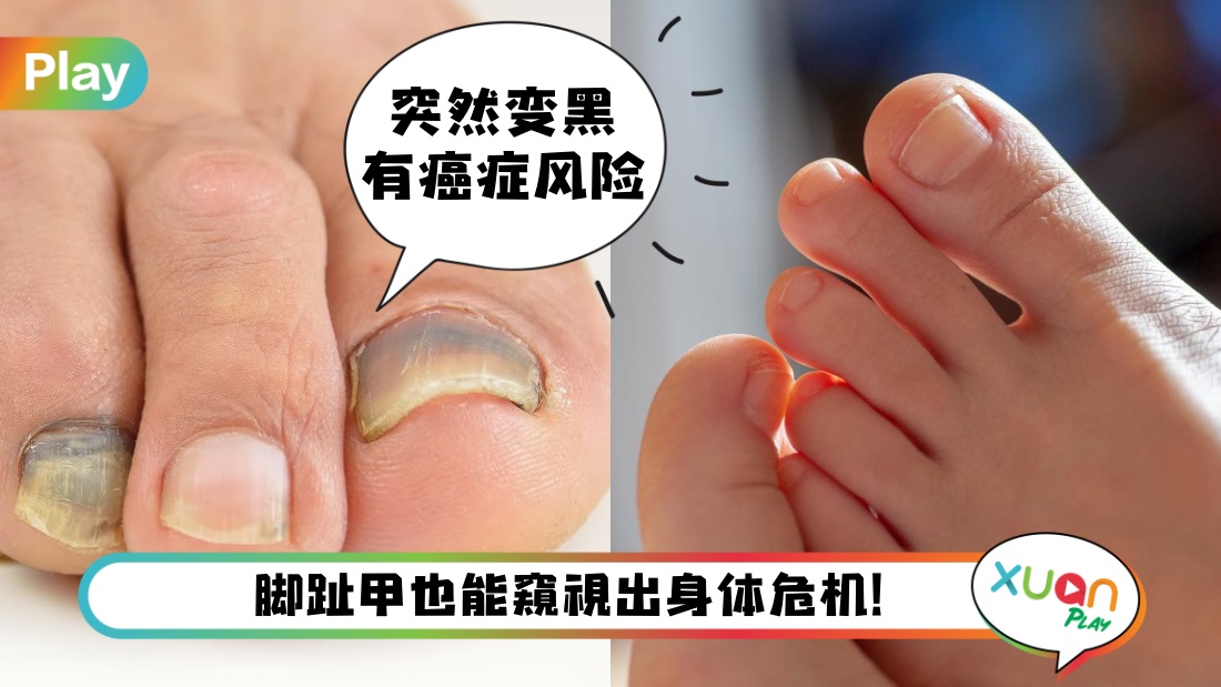 toenails.jpg