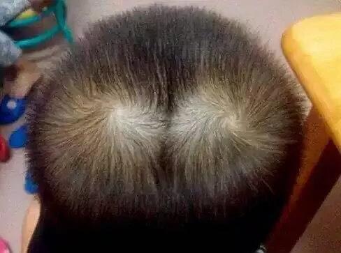 头有双旋