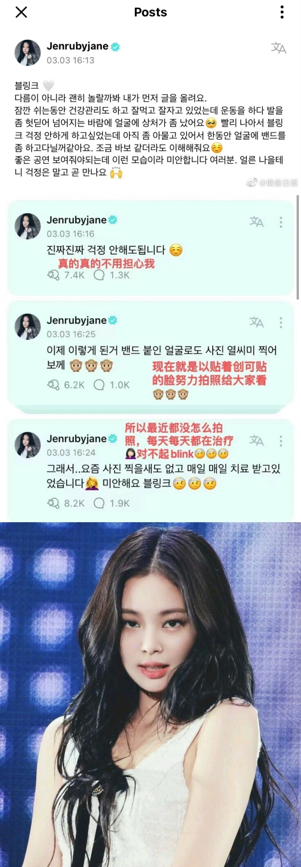 Jennie来马开唱前受伤