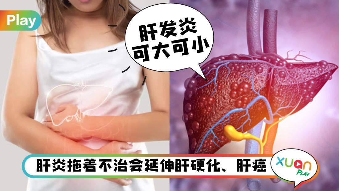 liver-health-must-be-take-care.jpg