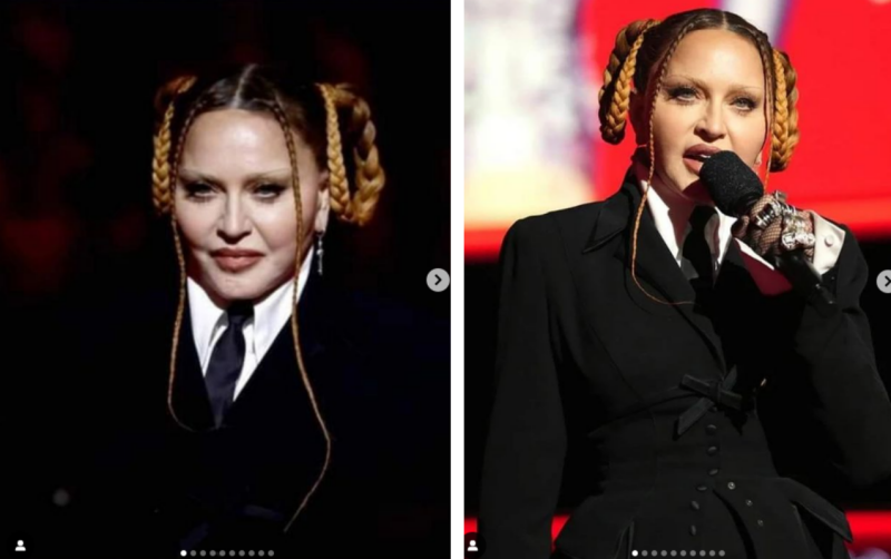 Madonna回应容貌羞辱