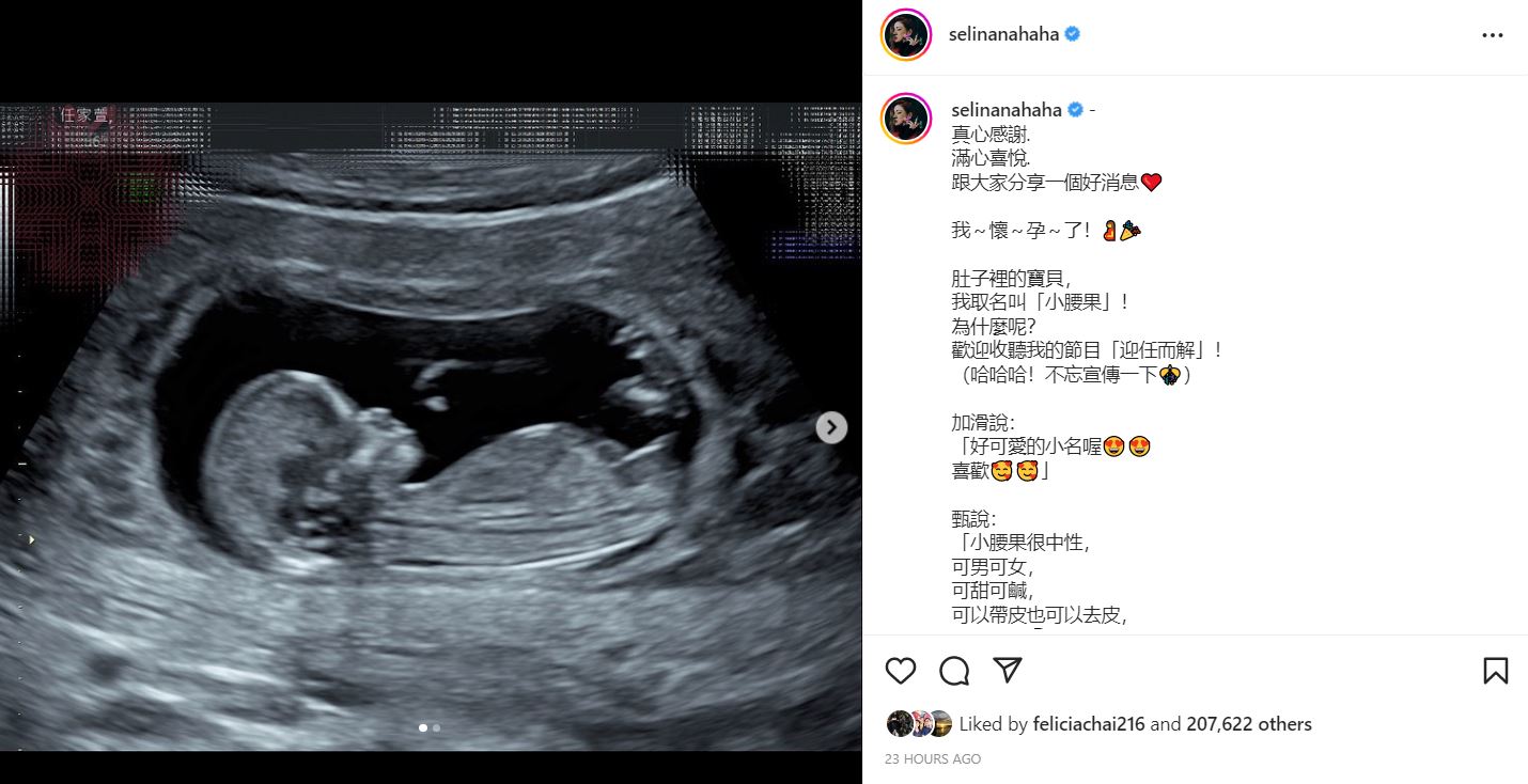 selina怀孕宣告
