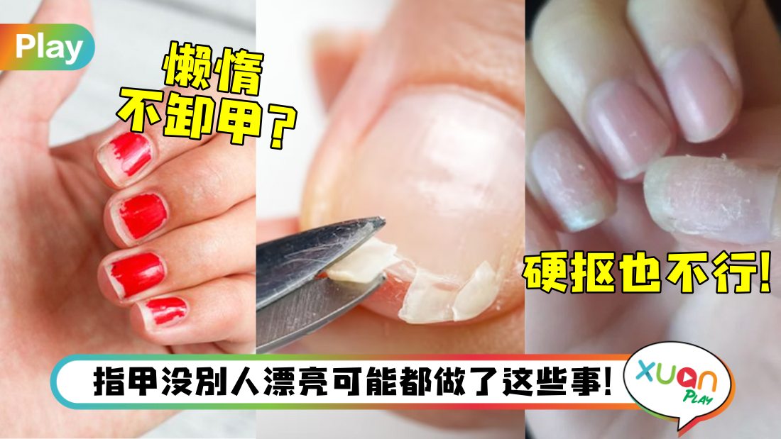 why-ugly-nail.jpg