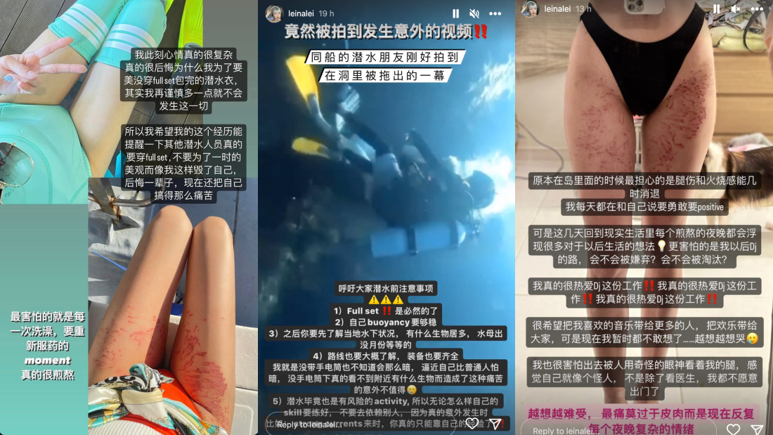 大马美女DJ潜水遭海葵蛰伤