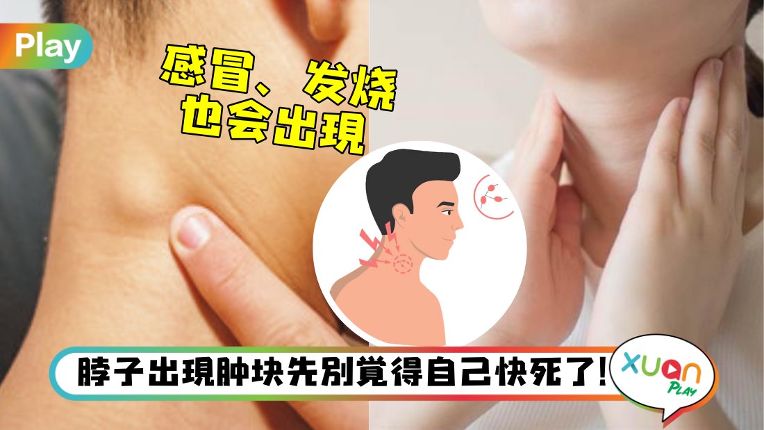 lymph-nodes.jpg