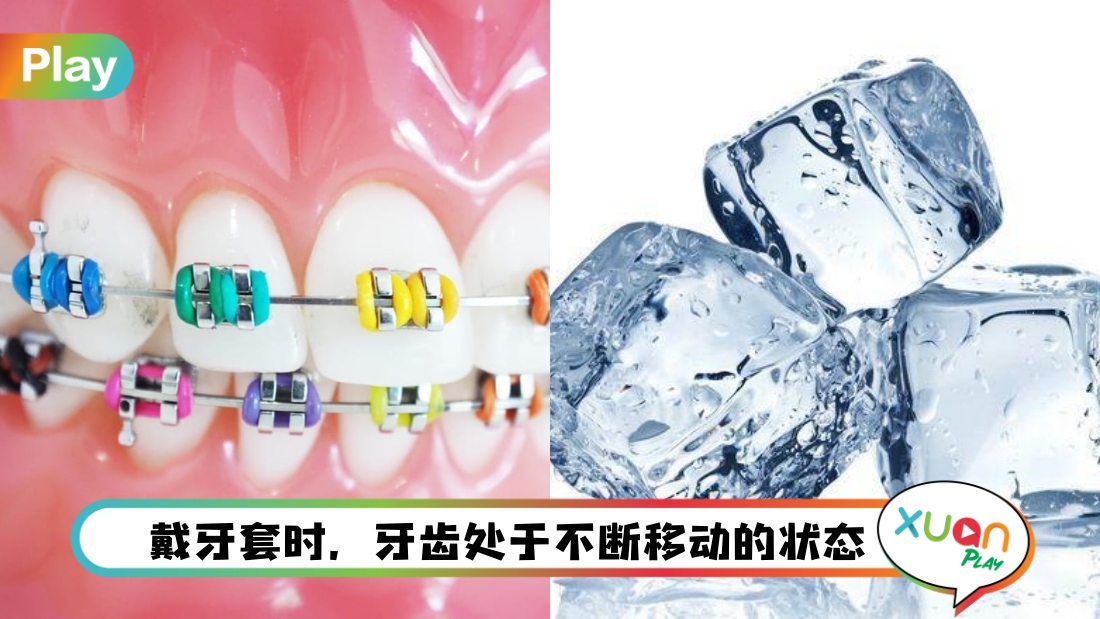 braces-main.jpg
