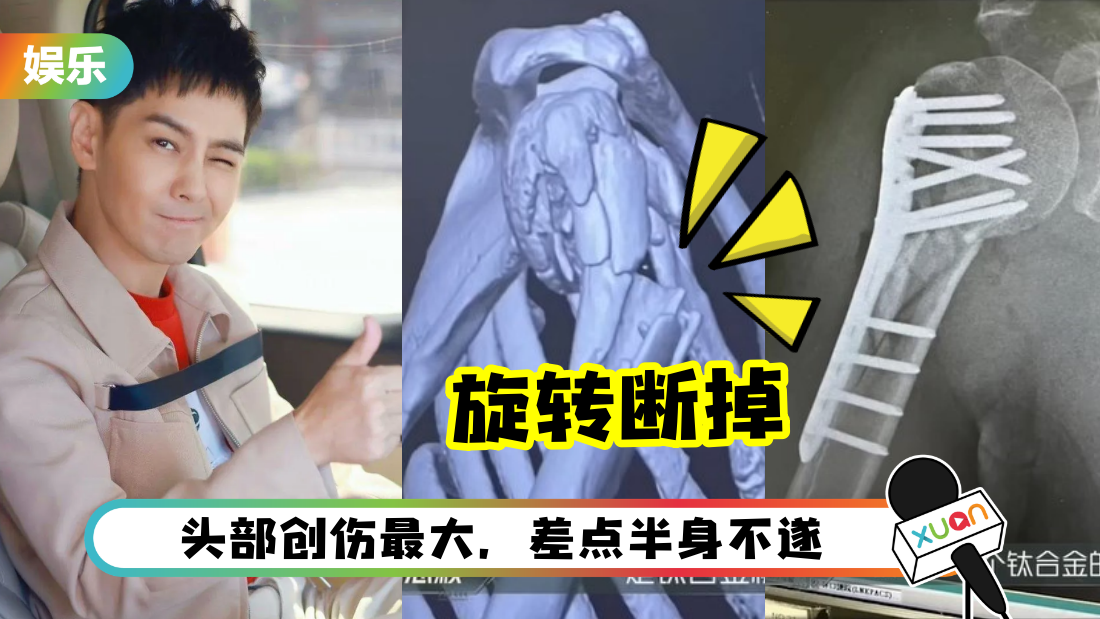 linzhiying-duandiao-cover.png