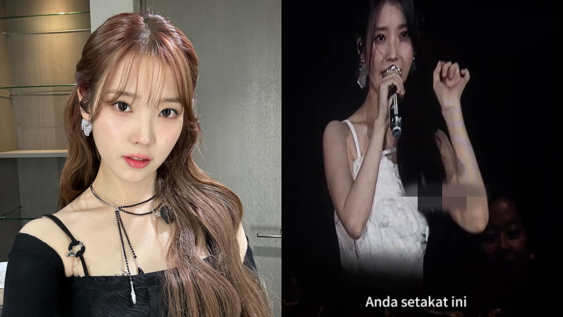 IU