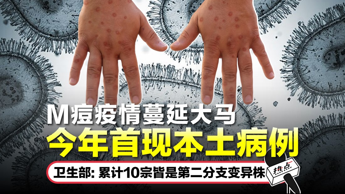 M痘来势汹汹! 我国出现今年首宗M痘病例 | 热点