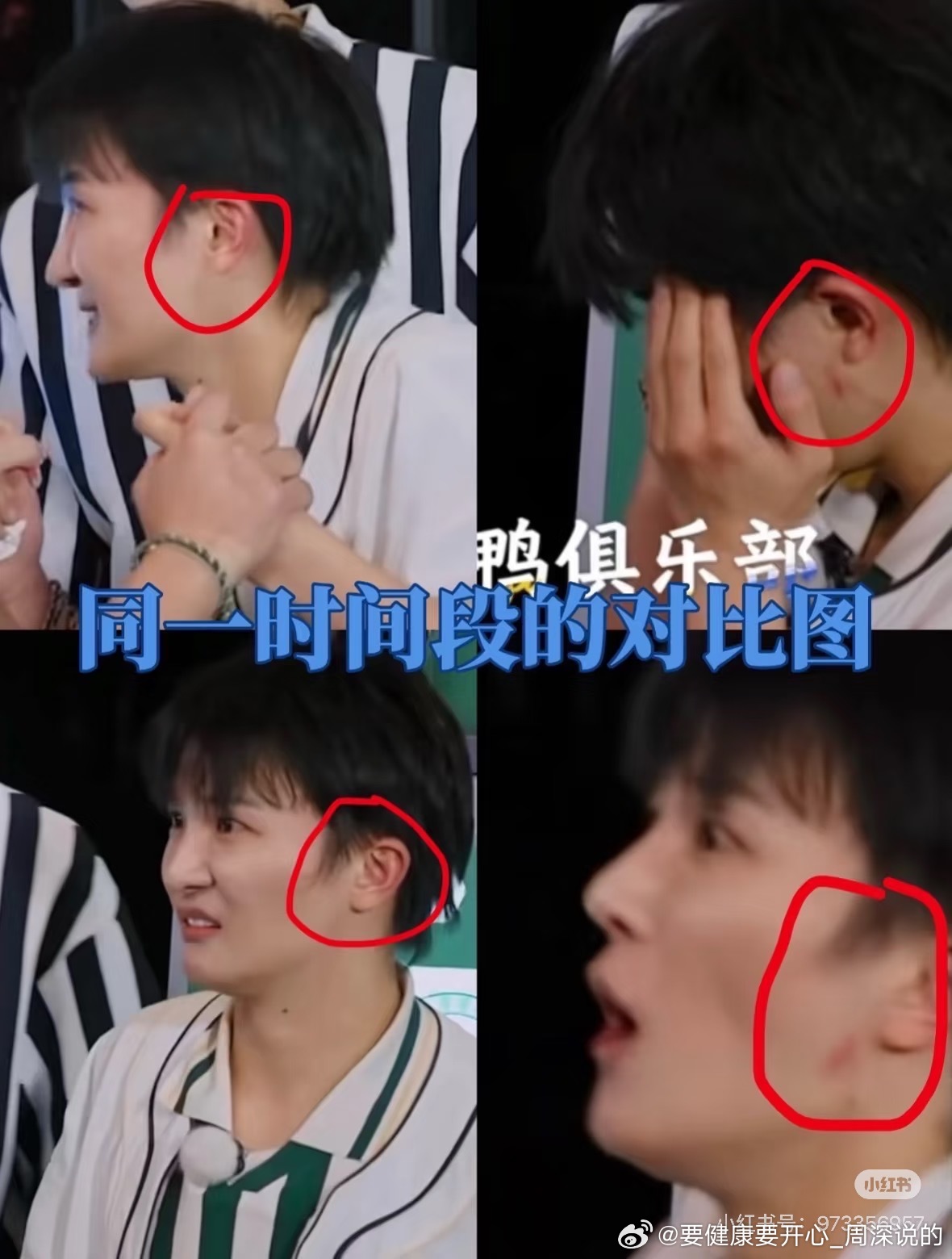 周深《奔跑吧》遭嘉宾强行拖拽11秒