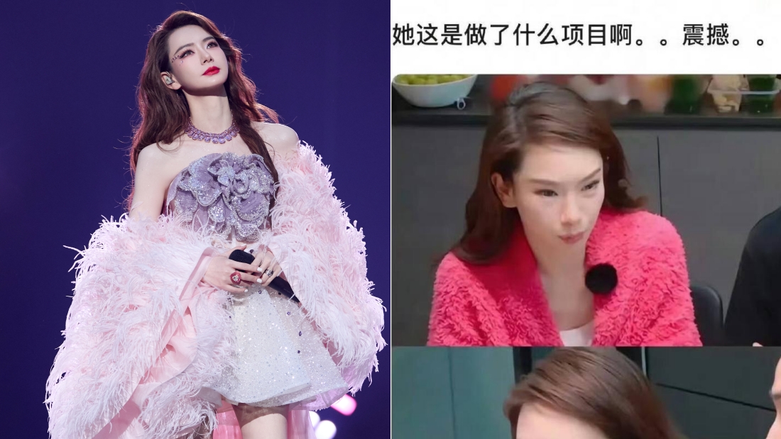 戚薇承认医美过度