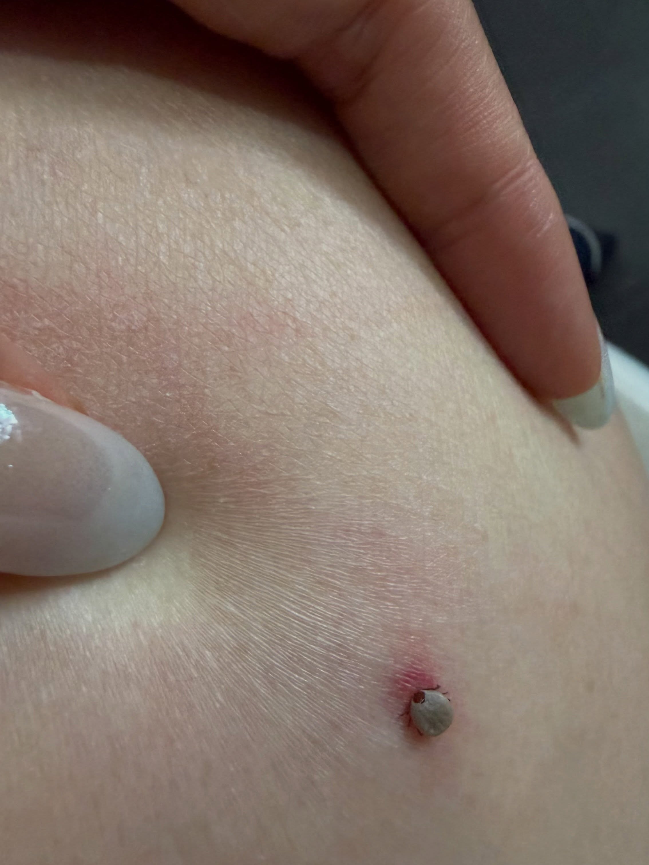 Tick