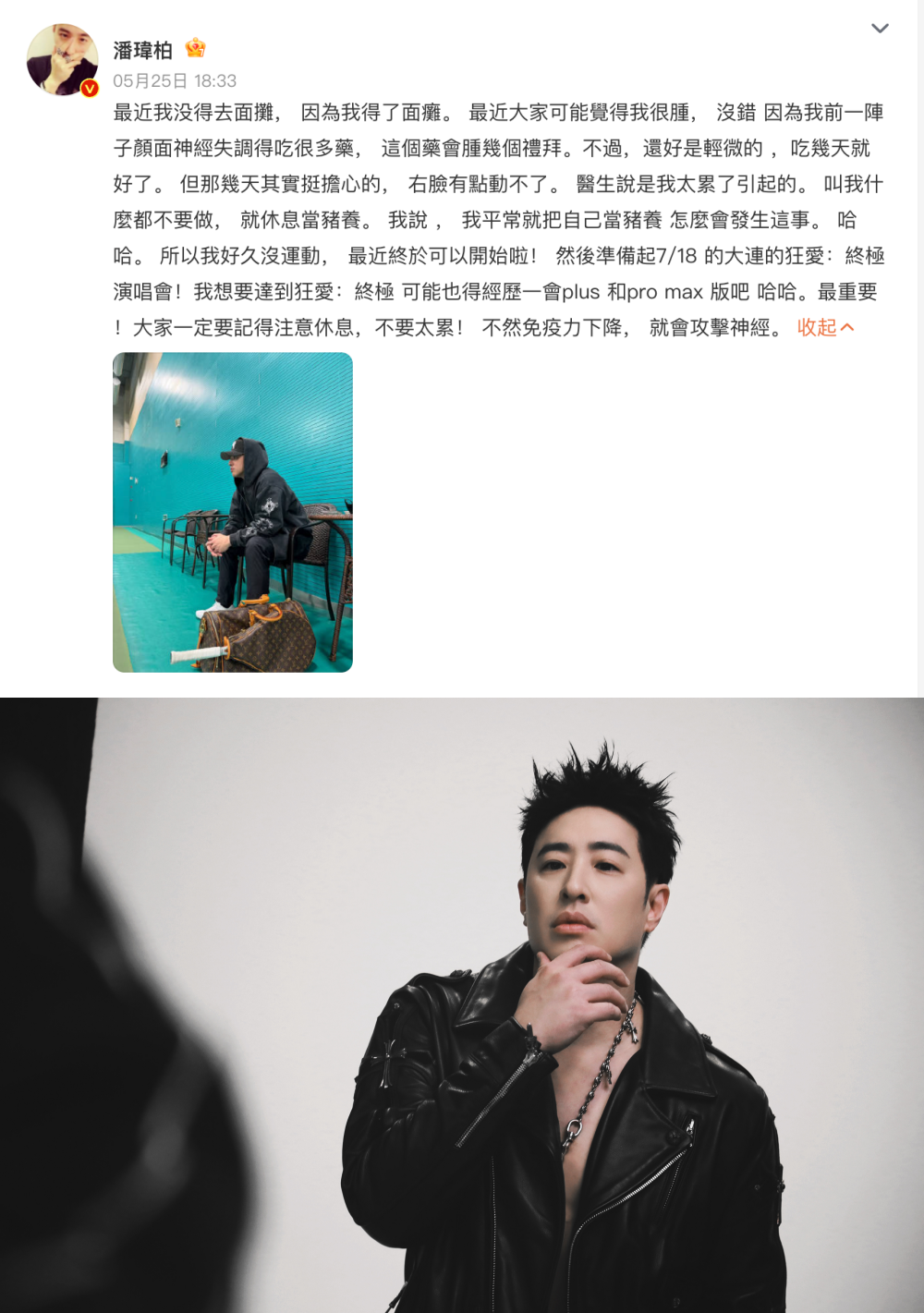 潘玮柏自曝颜面神经失调！
