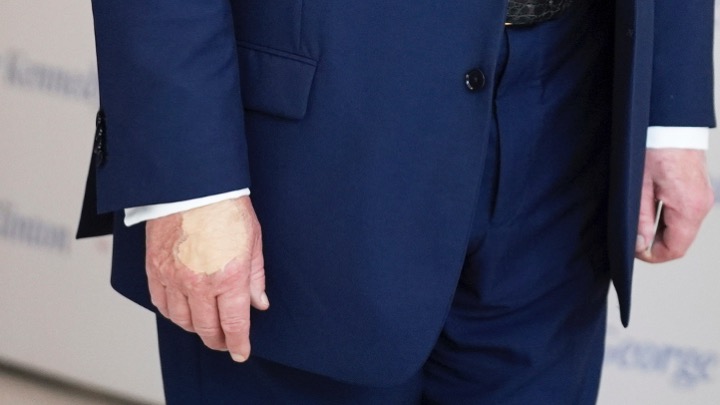 Trump Hand covered